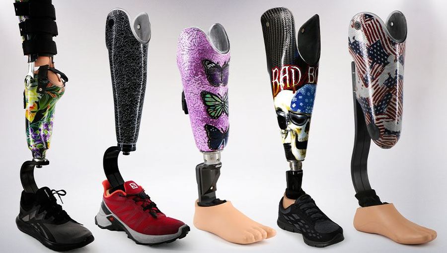 Lower limb prosthesis